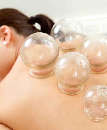 cupping